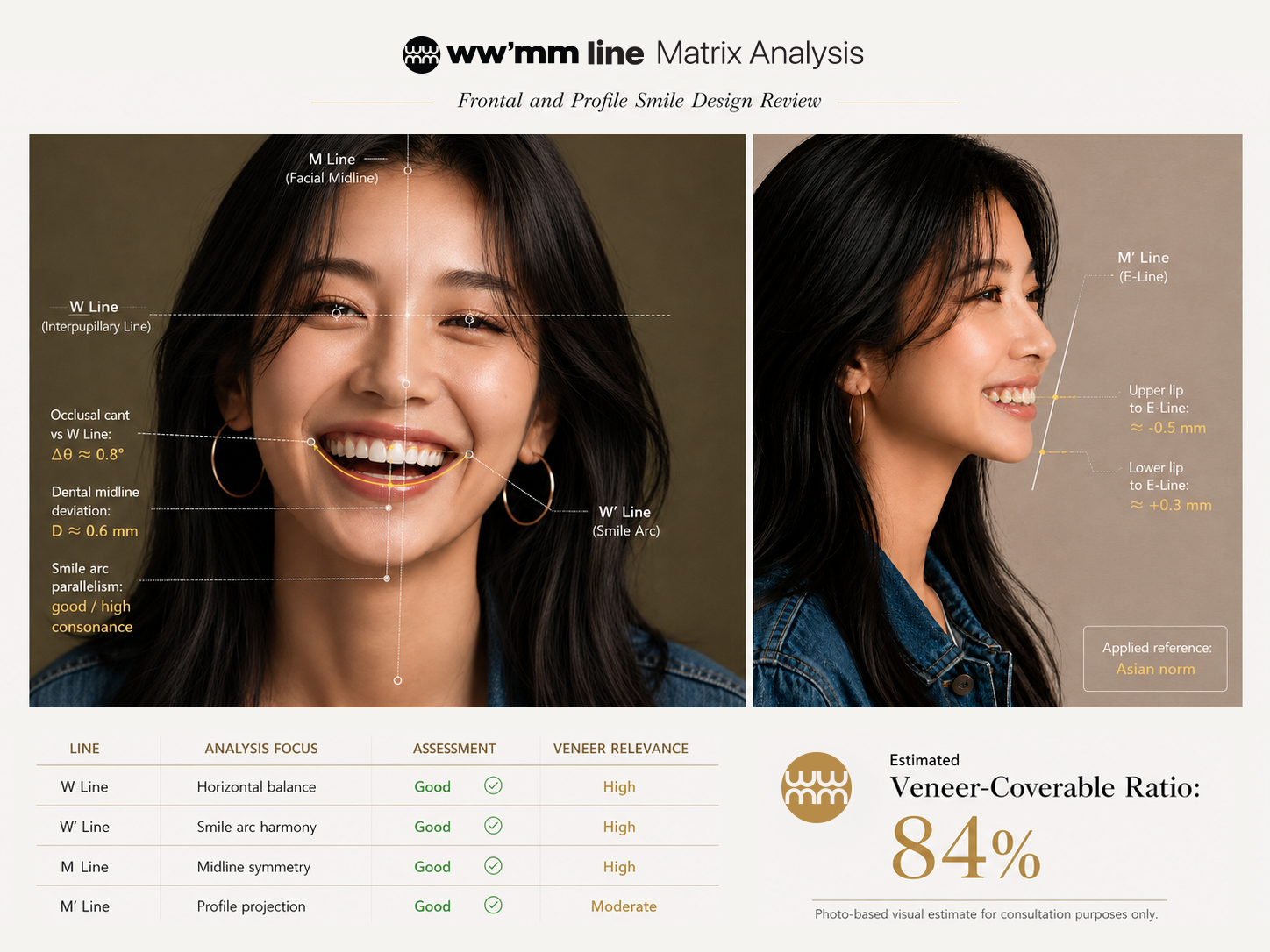ww'mm line matrix analysis